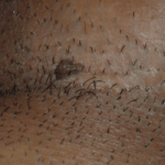 الثأليل التناسلية عند الرجال