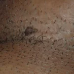 الثأليل التناسلية عند الرجال